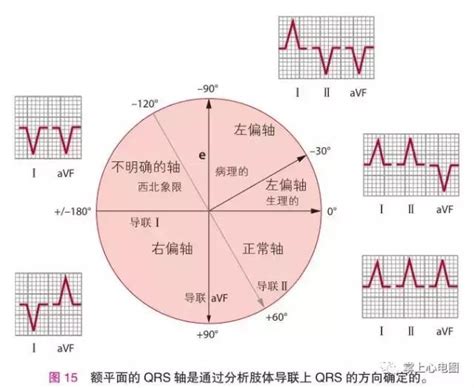 逆時針|心軸反時針轉向的原因